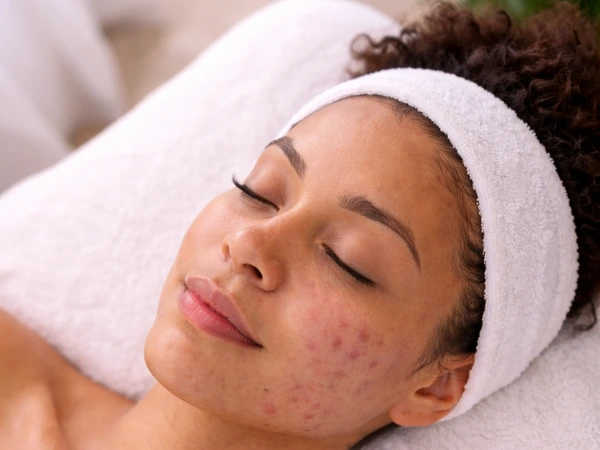 Corrective Clarity Treatment