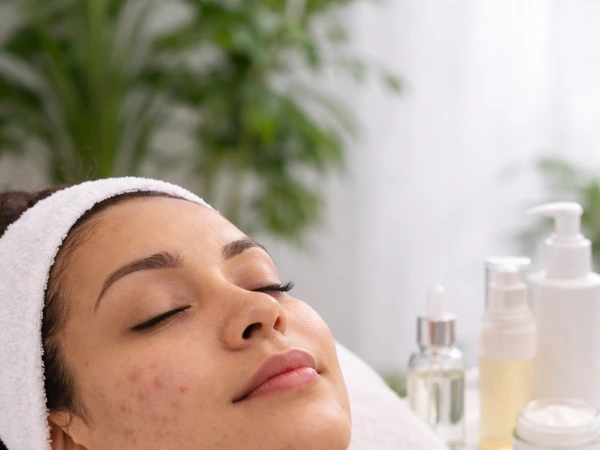 Acne and Blemish Care