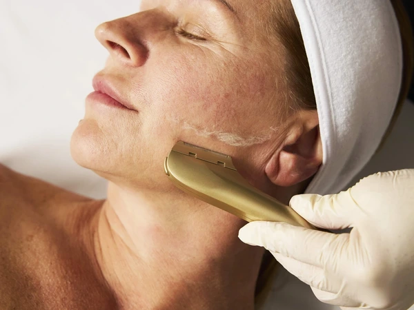 Luminous  DermaFlash & Refresh Peel