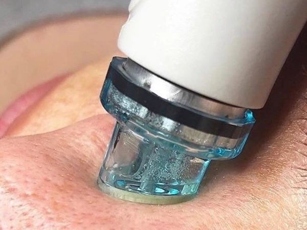 Hydro-Dermabrasion Facial