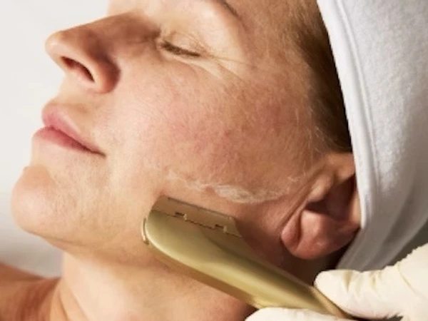 Dermaflash Facial