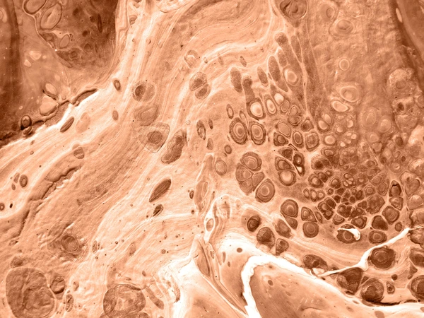Melasma Consultation & Corrective Plan