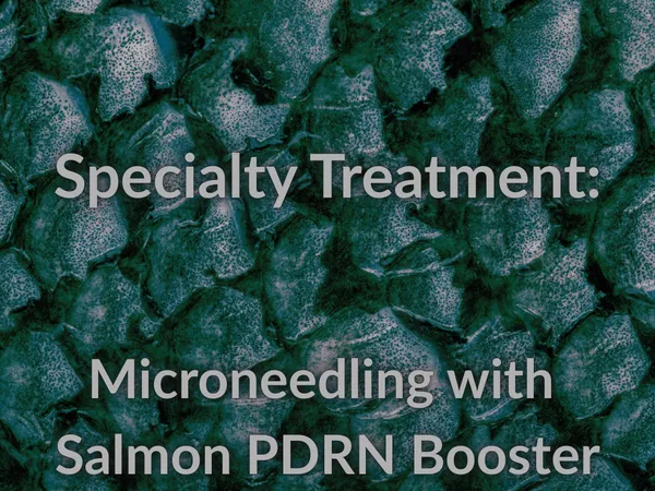 Radiance PDRN Microneedling Experience
