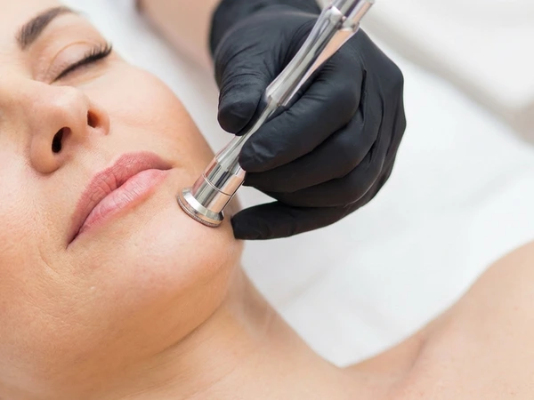 Microdermabrasion